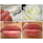 Отзывы людей о Аевит гель для губ