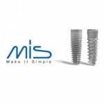 Отзывы людей о Импланты MIS