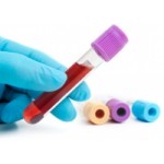 Отзывы людей о ЭПР ТСА тест