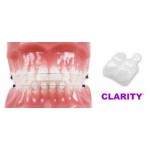 Отзывы людей о Брекеты Clarity Advanced Flash Free