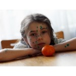 Отзывы людей о Ветряная оспа (ветрянка)