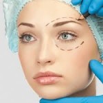 Отзывы людей о Блефаропластика