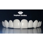 Отзывы людей о Implant Smiles - съемные виниры