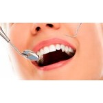 Отзывы людей о Стоматологическая клиника TSDENT